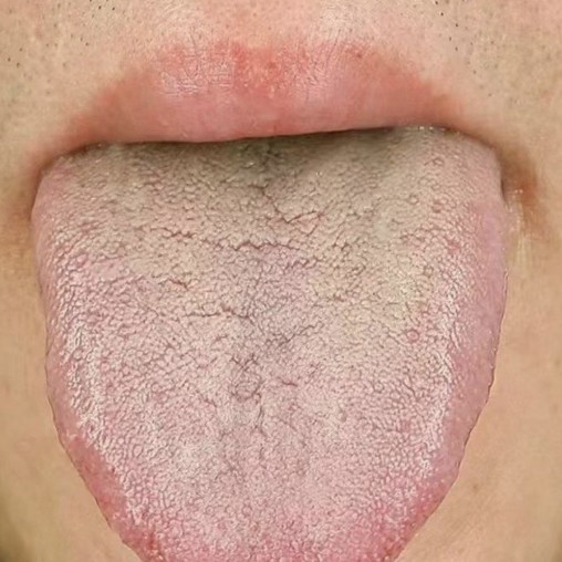 癌症恢复的差距，藏在6种体质里