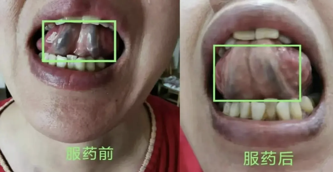 bee69f7c84f9e7f50f9b3f9d5d77b093.png bee69f7c84f9e7f50f9b3f9d5d77b093.png